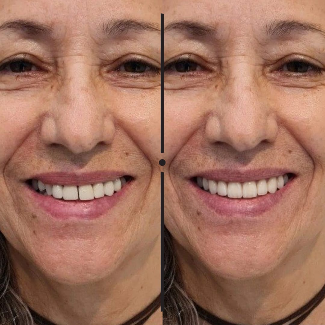 Condição atual e simulação digital do sorriso